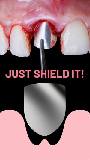 just-shield-it just-shield-it